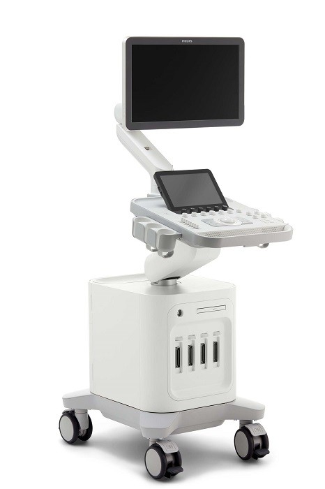 Ultrasound 3300 system